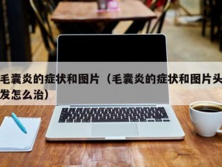 毛囊炎的症状和图片（毛囊炎的症状和图片头发怎么治）