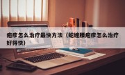 疱疹怎么治疗最快方法（蛇缠腰疱疹怎么治疗好得快）